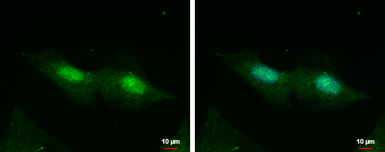 Anti-CXorf57 antibody used in Immunocytochemistry/ Immunofluorescence (ICC/IF). GTX120687