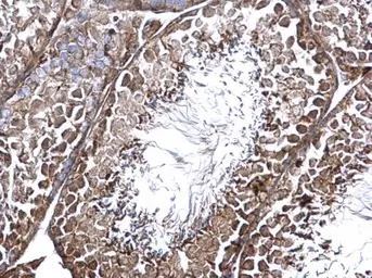 Anti-CNTROB antibody used in IHC (Paraffin sections) (IHC-P). GTX120691