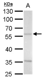 Anti-ADC antibody [N2C2], Internal used in Western Blot (WB). GTX120705