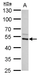 Anti-ADC antibody [N2C2], Internal used in Western Blot (WB). GTX120705