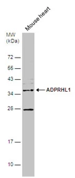 Anti-ADPRHL1 antibody used in Western Blot (WB). GTX120706