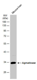 Anti-Agmatinase antibody used in Western Blot (WB). GTX120707