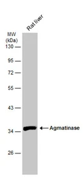 Anti-Agmatinase antibody used in Western Blot (WB). GTX120707