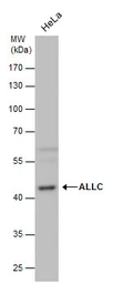 Anti-ALLC antibody used in Western Blot (WB). GTX120709