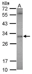Anti-ASB12 antibody [N1C3] used in Western Blot (WB). GTX120729