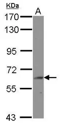 Anti-BIN2 antibody [N1N3] used in Western Blot (WB). GTX120736