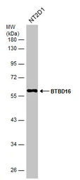 Anti-BTBD16 antibody used in Western Blot (WB). GTX120740