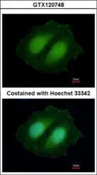 Anti-CBWD1 antibody [N2C3] used in Immunocytochemistry/ Immunofluorescence (ICC/IF). GTX120748