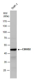 Anti-CBWD2 antibody used in Western Blot (WB). GTX120749