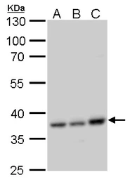 Anti-CCDC137 antibody used in Western Blot (WB). GTX120753