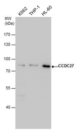 Anti-CCDC27 antibody used in Western Blot (WB). GTX120758