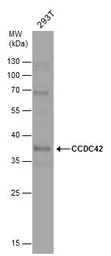 Anti-CCDC42 antibody used in Western Blot (WB). GTX120759