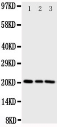 Anti-RKIP antibody used in Western Blot (WB). GTX12076