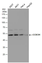 Anti-CCDC91 antibody used in Western Blot (WB). GTX120766