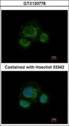 Anti-CHST7 antibody [N2C1], Internal used in Immunocytochemistry/ Immunofluorescence (ICC/IF). GTX120778
