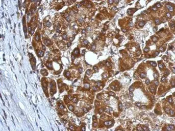 Anti-CHST7 antibody [N2C1], Internal used in IHC (Paraffin sections) (IHC-P). GTX120778