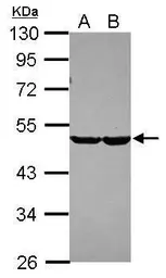 Anti-CHST7 antibody [N2C1], Internal used in Western Blot (WB). GTX120778
