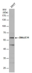 Anti-DNAJC11 antibody used in Western Blot (WB). GTX120802