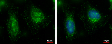 Anti-FAM21C antibody used in Immunocytochemistry/ Immunofluorescence (ICC/IF). GTX120832