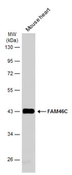 Anti-FAM46C antibody used in Western Blot (WB). GTX120834