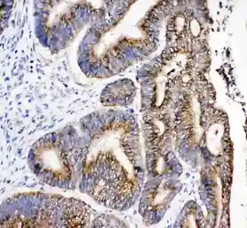 Anti-HSD17B4 antibody used in IHC (Paraffin sections) (IHC-P). GTX12084