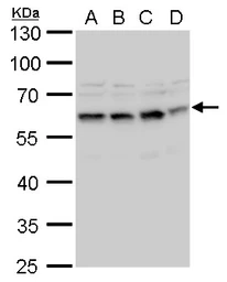 Anti-STCH antibody used in Western Blot (WB). GTX120858
