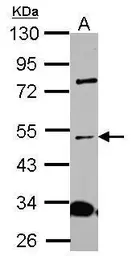Anti-ALS2CR15 antibody used in Western Blot (WB). GTX120861