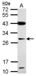 Anti-IMP4 antibody used in Western Blot (WB). GTX120864