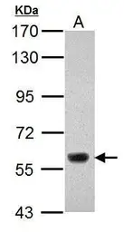 Anti-KDM4D antibody used in Western Blot (WB). GTX120872