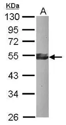 Anti-KLF17 antibody used in Western Blot (WB). GTX120877