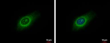 Anti-LARP1 antibody used in Immunocytochemistry/ Immunofluorescence (ICC/IF). GTX120884