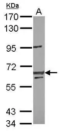 Anti-LIN54 antibody [C1C2], Internal used in Western Blot (WB). GTX120890