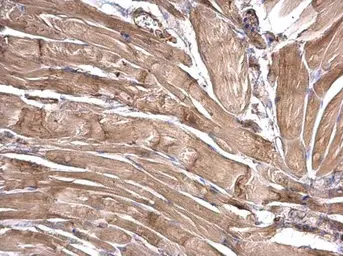 Anti-LRRFIP2 antibody used in IHC (Paraffin sections) (IHC-P). GTX120901