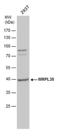 Anti-MRPL38 antibody used in Western Blot (WB). GTX120918
