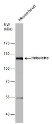 Anti-Nebulette antibody used in Western Blot (WB). GTX120922