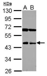 Anti-NEU4 antibody [N3C3] used in Western Blot (WB). GTX120923