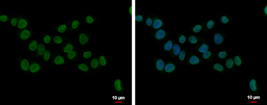 Anti-NIP7 antibody used in Immunocytochemistry/ Immunofluorescence (ICC/IF). GTX120926