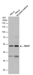 Anti-NKAP antibody used in Western Blot (WB). GTX120929