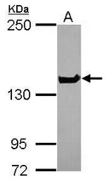 Anti-NUP155 antibody [C1C3] used in Western Blot (WB). GTX120945
