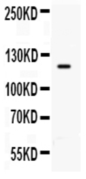 Anti-TLR8 antibody used in Western Blot (WB). GTX12096