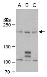 Anti-PCF11 antibody used in Western Blot (WB). GTX120962