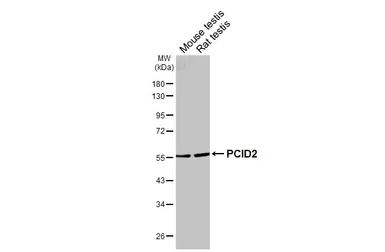 Anti-PCID2 antibody used in Western Blot (WB). GTX120963