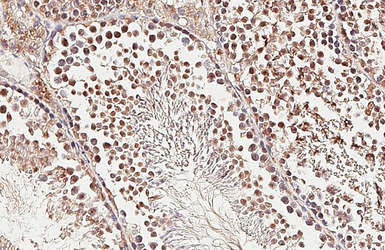 Anti-PCID2 antibody used in IHC (Paraffin sections) (IHC-P). GTX120963