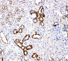 Anti-GLUT5 antibody used in IHC (Paraffin sections) (IHC-P). GTX12098
