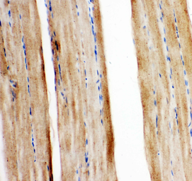 Anti-GLUT5 antibody used in IHC (Paraffin sections) (IHC-P). GTX12098