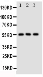 Anti-GLUT5 antibody used in Western Blot (WB). GTX12098