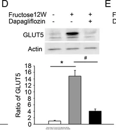 Anti-GLUT5 antibody used in Western Blot (WB). GTX12098
