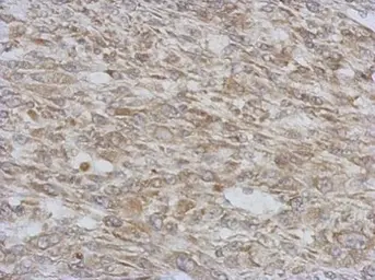 Anti-RAB11-FIP5 antibody [N2C1], Internal used in IHC (Paraffin sections) (IHC-P). GTX120985