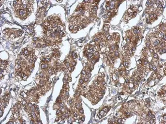 Anti-RAB11-FIP5 antibody [N2C1], Internal used in IHC (Paraffin sections) (IHC-P). GTX120985