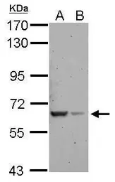 Anti-RAB11-FIP5 antibody [N2C1], Internal used in Western Blot (WB). GTX120985